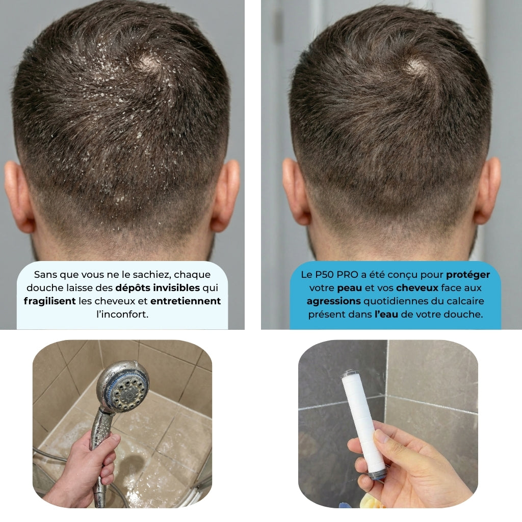 P50 PRO™ - Soin Protecteur Peau & Cheveux